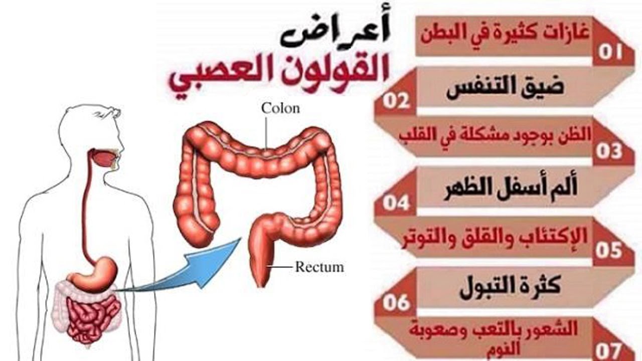 ما اعراض القولون العصبي , اعراض متلازمة القولون المتهيج