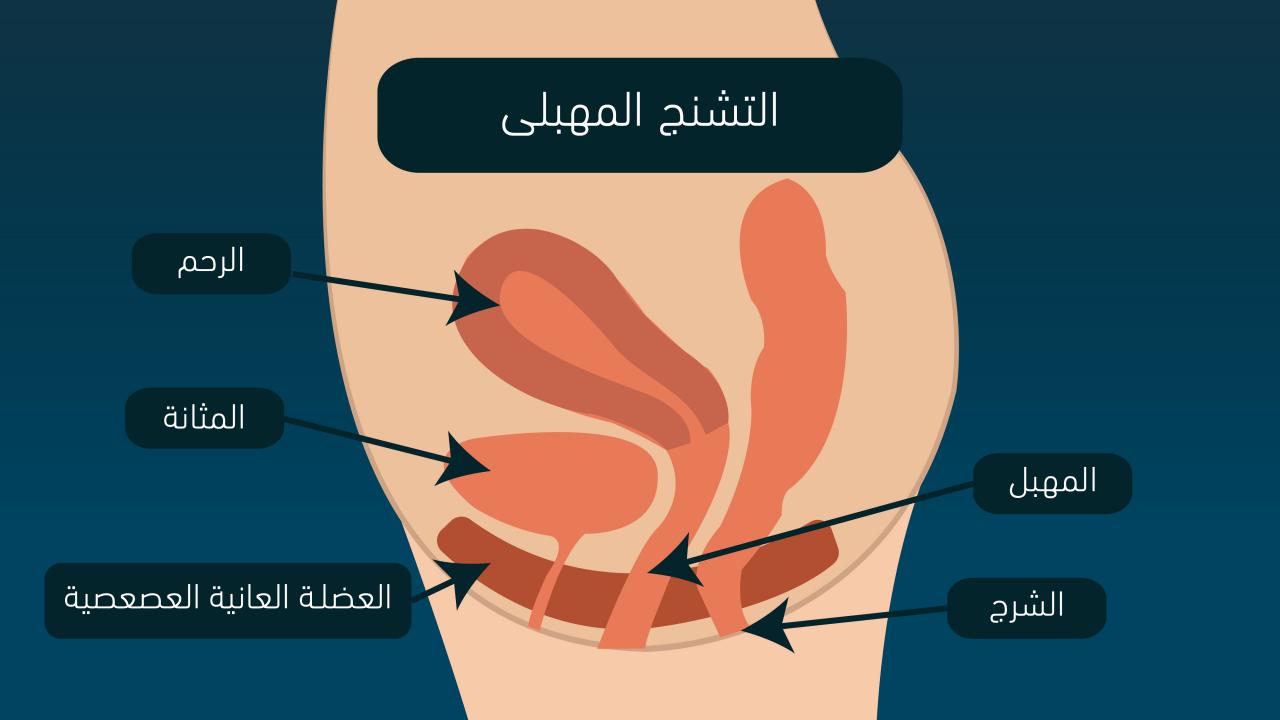 تمارين علاج التشنج المهبلي بالصور , لشد عضلة المهبل بعض التمارين السهلة