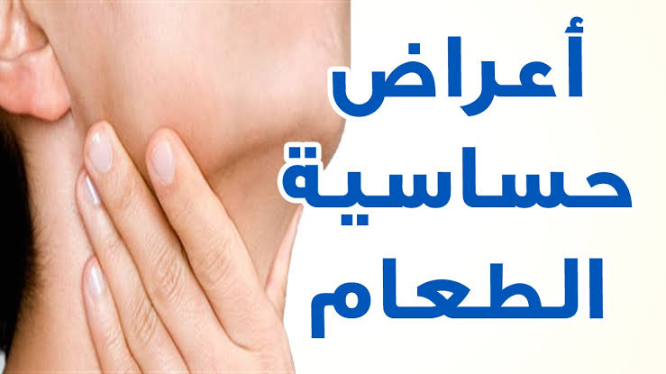 اعراض حساسية الطعام - اسباب حساسية الطعام 2369 2