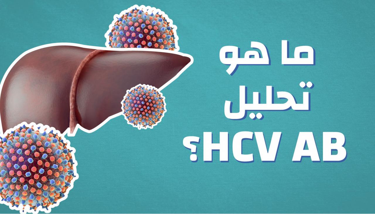 ما هو تحليل hcv ab , معلومات عن تحليل التهاب الكبد الفيروسي