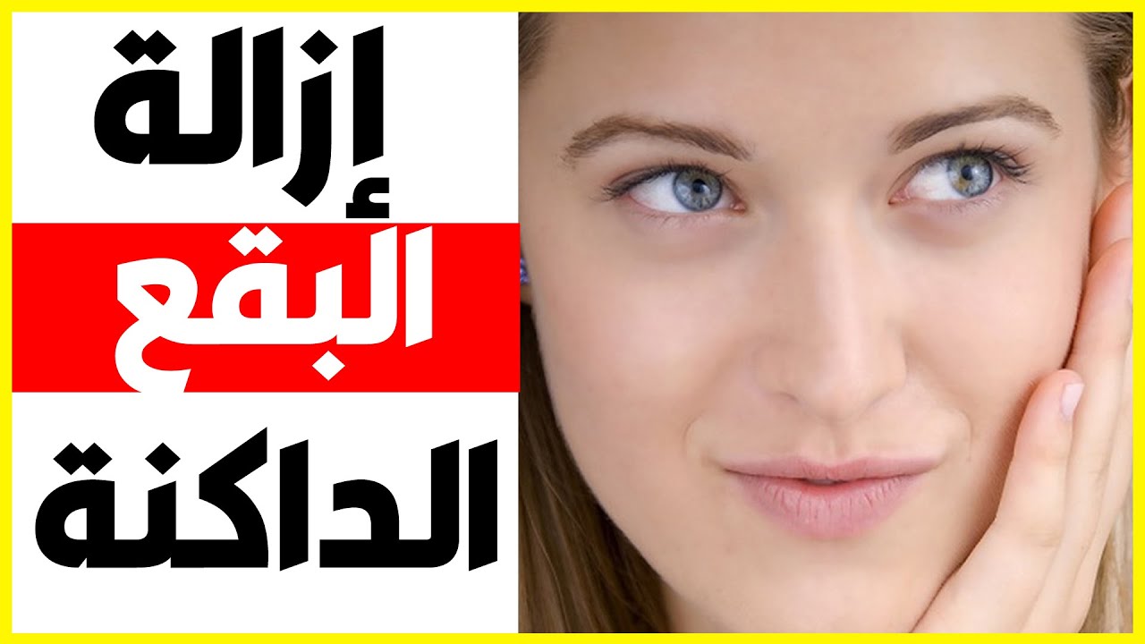 ازالة البقع البنية من الوجه - خلي وجهك صافي وتمتعي بانوثتك 3502