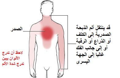 اسباب اوجاع الصدر - صدري يؤلمني ولا اشتكي من شئ ماذا يكون 757 2