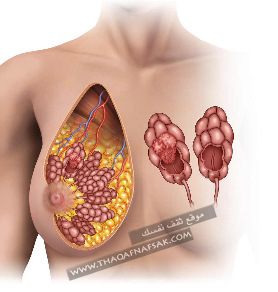 وجع حلمة الصدر - اسباب ومشاكل حلمة الصدر 3836