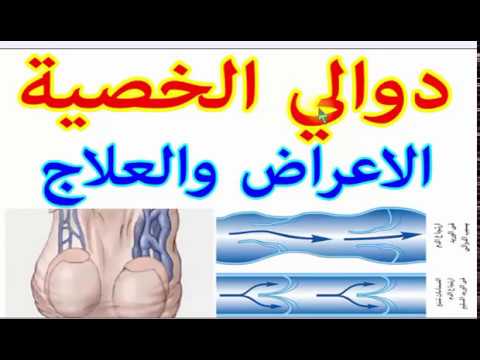 علامات فشل عملية دوالي الخصية - تعرف على مضاعفات عمليه دوالي الخصيه 2339