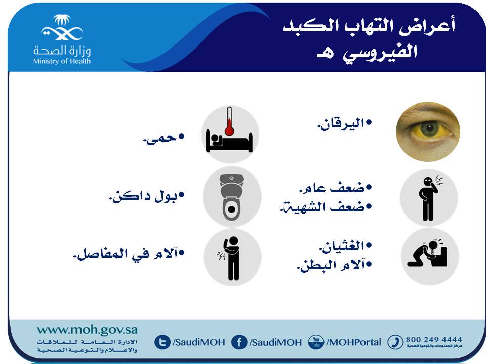 اعراض التهاب الكبد - مشاكل الكبد منها التهاب المزمن للكبد 5531 2