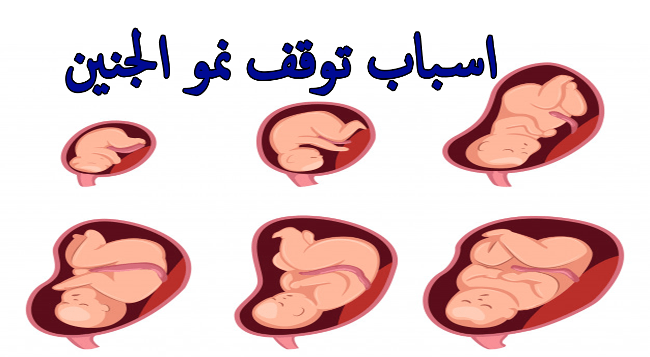 اسباب توقف نمو الجنين , لن تتخيل اسباب موت الجنين