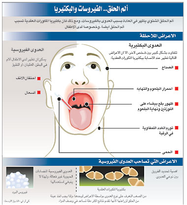 الم في الجهه اليسرى من الحلق - اسباب التهاب البلعوم لكن من جهة واحدة 4002 1