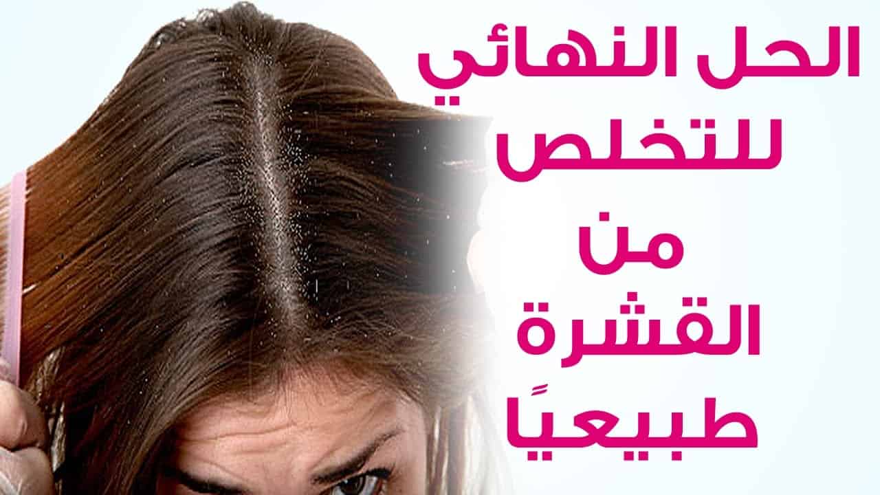 وصفة لقشرة الشعر - واو مكنتش متخيله الفرق جامد كده 3608 2