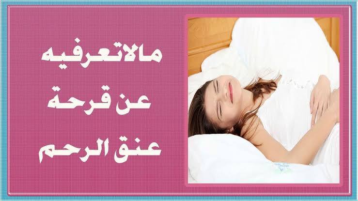 علاج قرحة عنق الرحم - اسرع علاج لقرحه الرحم 1759 3