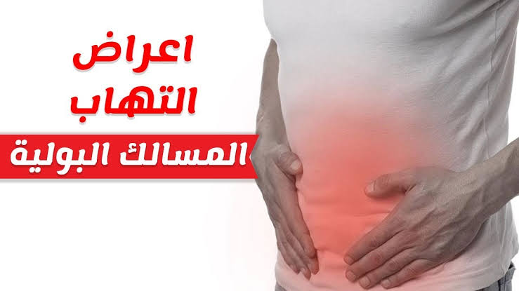 اسباب التهاب البول - حرقان في المسالك البولية السبب والاعراض 3837 3