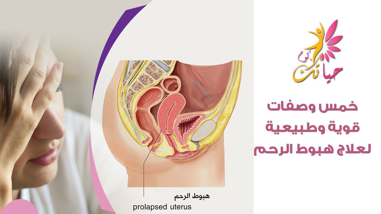 صور هبوط المهبل- اعراض هبوط المهبل بالصور 3089 6