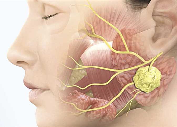 اعراض التهاب العصب الخامس , لو اتعرضط للاعراض دي اعرف ان عندك التهاب في العصب